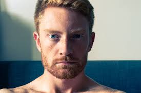 Again, this is just before and after the application of minoxidil, not necessarily before and after the minoxidil journey, as many of these. Does Minoxidil Work For Beards