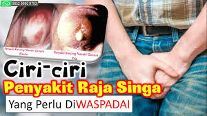 Watch the new trailer now. Ciri Ciri Penyakit Raja Singa Yang Perlu Diwaspadai Youtube