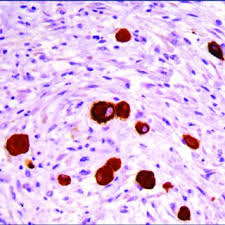 Causes asbestos is the main cause of mesothelioma in dogs. Pdf Sclerosing Peritoneal Mesothelioma In A Dog Histopathological Histochemical And Immunohistochemical Investigations