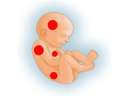 Universitatea de medicină şi farmacie „carol davila din bucureşti a celebrat debutul zilelor universităţii, concomitent cu deschiderea oficială a anului universitar. Irina Parvu Medic Specialist Obstetrica Ginecologie Spitalul Clinic Dr I Cantacuzino Linkedin