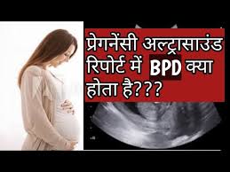 प र गन स अल ट र स उ ड र प र ट म Bpd क य ह त ह Bpd In Pregnancy Pregnancy Ultrasound Report Youtube