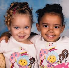These Twins Will Make You Rethink Race