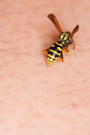Wie Sie Einem Wespenstich Am Besten Vorbeugen Oder Ihn Im Aktufall Behandeln Lesen Sie Bei Praxisvita Insekten Insektenstich Wespenstich