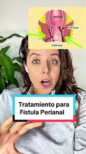 Cirugía de Fístula Perianal: Métodos y Recuperación