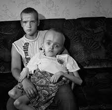 Radioaktiver staub verteilte sich in ganz europa, hunderttausende. 20 Jahre Nach Dem Gau Telepolis