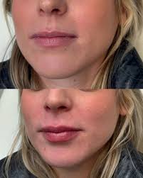 Join Our Breast Cancer & Wellness Seminar for Women's Health and Prevention