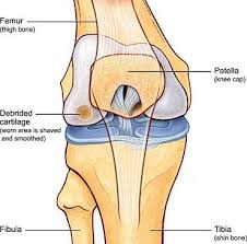 Pin On Knee Replacement In India
