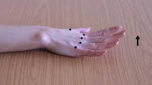 Image result for Elson Extensor Tendon Test