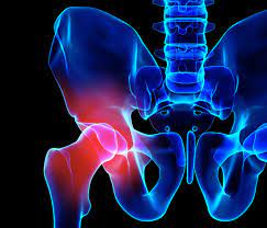 Hip And Knee Pain 5 Symptoms You Shouldn T Ignore