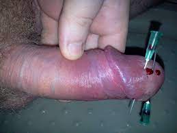 Razrezannyj Chlen Porno 61 Foto