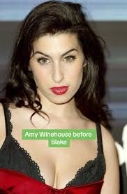 Amy Winehouse Kratzer Blake