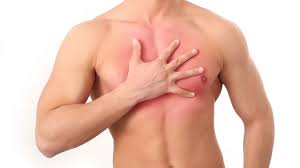 Acid reflux or gerd (gastroesophageal reflux disease), which is a more scientific and many of the best things in life can relax the sphincter, including chocolate, alcohol, nicotine, caffeine, and greasy, spicy here are some of the best natural home remedies to try for the occasional bout of acid reflux. How To Get Rid Of Heartburn 10 Top Tips On How To Stop Acid Reflux Mirror Online