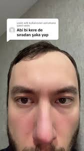 Abi Normal's Instagram, Twitter & Facebook