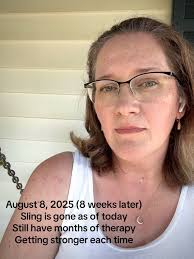 How Long Do You Have to Stay in The Hospital After Rotator Cuff Surgery