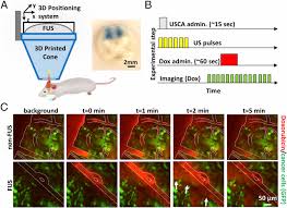 Doctors do not know what causes brain cancer in most cases, but there are certain factors that can increase your risk. Mechanisms Of Enhanced Drug Delivery In Brain Metastases With Focused Ultrasound Induced Blood Tumor Barrier Disruption Pnas
