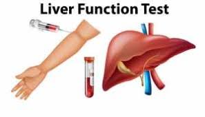 Image result for Liver Function Test
