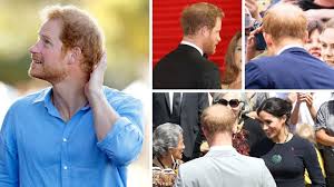 Prince Harry's Bald Spot Has Doubled in ...