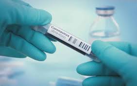 The number and types of available tests vary widely based on geographic region and health care facility. Fast And Inexpensive Covid 19 Test Uses Genetic Editing Technique Olhar Digital
