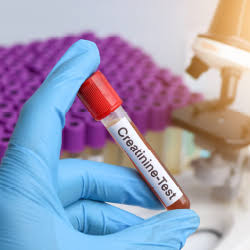 CREATININE product image