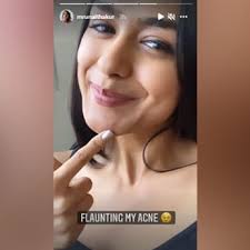 Is your face regularly and flawlessly snatched? Zxmq8rbbmwfdxm