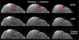 Be notified of new releases. Lisa Improves Statistical Analysis For Fmri Nature Communications