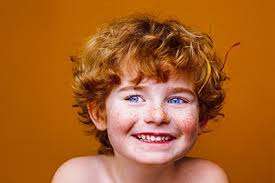 Image result for Freckled skin