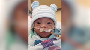 Treatment for Tetralogy of Fallot