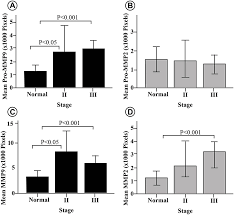 For example, stage 4 prostate cancer includes stage 4a, in which cancer has spread to local (also called regional) lymph. Matrix Metalloproteases In Breast Cancer Bctt Bctt