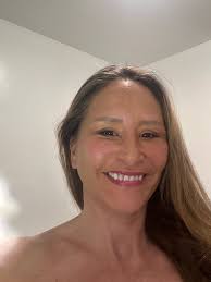 Face-lift & Neck-lift Support Group