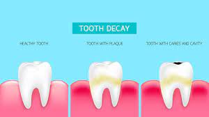 For many people, math is probably their least favorite subject in school. Four Things Are Required For Dental Trivia Answers Quizzclub