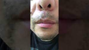 Twitching involves small muscle contractions in the body. Top Lip Twitching Youtube