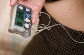 Most insulin pumps cost thousands of dollars and are purchased through insulin pump companies or durable medical equipment suppliers. Wa Lawmakers Propose Capping Insulin Costs At 100 A Month Bellevue Reporter