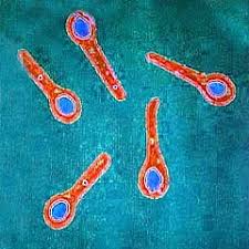 Tetanus is an infection caused by bacteria called clostridium tetani. Clostridium Tetani Encyclopedia Article Citizendium