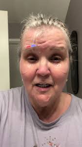 Hydration and Firming with Hydrogel Eye Pads