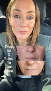 Reel by Corinna Tolan Skin Health Expert (@corinna_monicatolanbeauty) ·  August 21, 2025