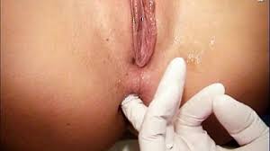 Teenage brunette nelia visiting gyno doctor who opens and examines her tight pussy. Valerie Pussy Gaping By Old Gyno Doctor With Speculum Ngebokep