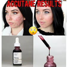 The ordinary aha 30% + bha 2% peeling solution has four different types of ahas: The Ordinary Aha 30 Bha 2 Peeling Solution 30ml Buy Online At Best Prices In Pakistan Daraz Pk