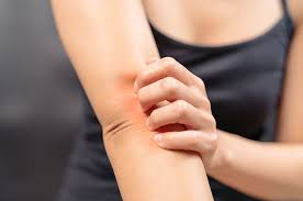 Maybe you would like to learn more about one of these? Kulit Gatal Belum Tentu Panuan Bisa Jadi Itu Pruritus