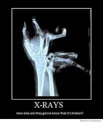 Xrays Demotivational Jpg 450 534 Pixels X Ray Humor Bones Funny