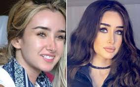 اختيار المركز الصحي المراد أخذ. Ù‡Ù†Ø§ Ø§Ù„Ø²Ø§Ù‡Ø¯ ØªÙƒØ´Ù Ø¢Ø®Ø± ØªØ·ÙˆØ±Ø§Øª Ø­Ø§Ù„ØªÙ‡Ø§ Ø§Ù„ØµØ­ÙŠØ© Ø¨Ø¹Ø¯ Ø¥ØµØ§Ø¨ØªÙ‡Ø§ Ø¨Ù€ ÙƒÙˆØ±ÙˆÙ†Ø§ Ø¶Ø±Ø¨Ø§Øª Ø§Ù„Ù‚Ù„Ø¨ Ø³Ø±ÙŠØ¹Ø©