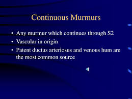 Image result for Venous Hum