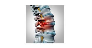 Image result for vyhřezlá ploténka