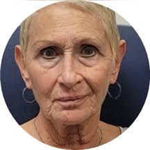 Beverly Strauss Dipaolo, NP