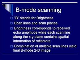 Pin On Ultrasound Notes