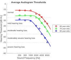 db hl sensitivity to sound clinical audiograms