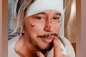 American actor mickey rourke as a jewish drug addict from brooklyn in the film 'bullet', 1996. Mickey Rourke Wraps Greece Shoot On Man Of God Exclusive News Screen