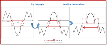 Rimp To Assess Rv Function What Is Rimp Aaa