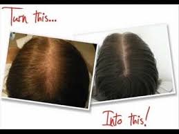 Vist jamaican mango lime store here. How To Use Jamaican Black Castor Oil Hair Growth