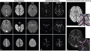 I bought an unpatched switch and a rcm loader. Neuronavigation Using Susceptibility Weighted Venography Application To Deep Brain Stimulation And Comparison With Gadolinium Contrast In Journal Of Neurosurgery Volume 121 Issue 1 2014