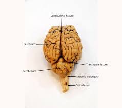 Image Result For Sheep Brain Labeled Nursing Study Guide Anatomy And Physiology Nursing Study